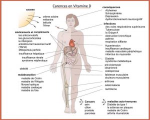 Carences en Vitamine D